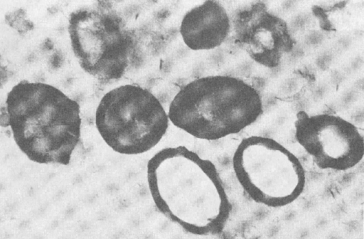 L-форма микобактерий туберкулёза