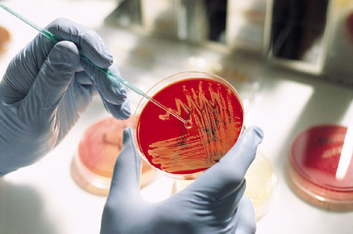 Микробиологическая диагностика туберкулеза
